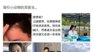 知名女演员自爆“斑秃”，头发还有希望长回来吗？