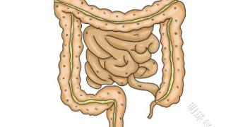 为什么肠癌一经发现通常就是晚期？45岁后，建议你定期做肠镜