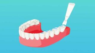 补牙能不能用网上买的树脂