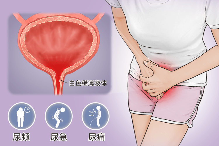 性病种类繁多，症状不同，以下是常见的6类