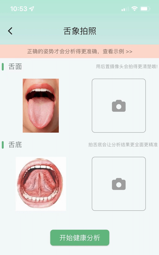 当中医碰上人工智能：科研人员新研发的AI智能系统舌诊准确率高达94%