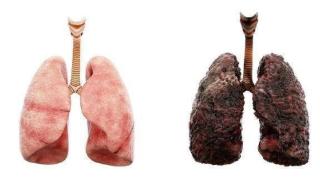 长期抽烟的人，若无“1粗”“2疼”，值得庆幸，你的肺还不算坏