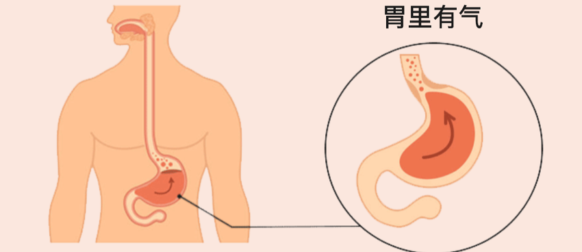 趴桌午休后，为什么会打嗝、感到胃胀、有呕吐感？