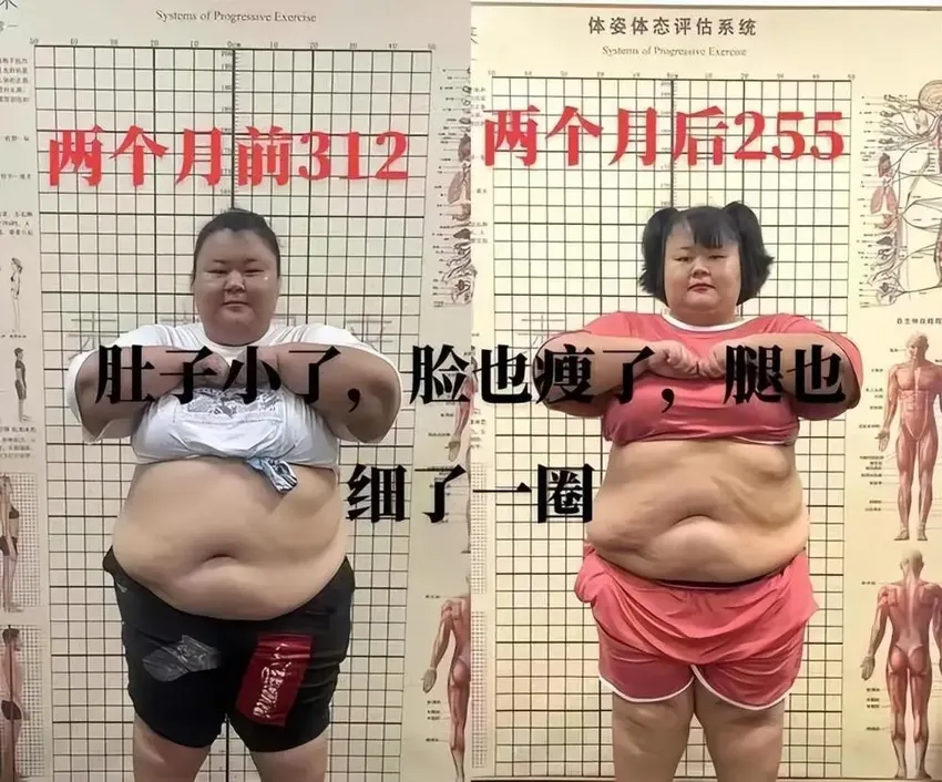 又一美女网红去世令人遗憾！去世之前曾想减200斤，父母悲恸