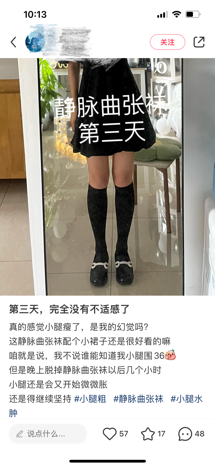 穿静脉曲张袜能”瘦腿”？ 重庆市药监局：没有燃脂功能，使用不当有副作用