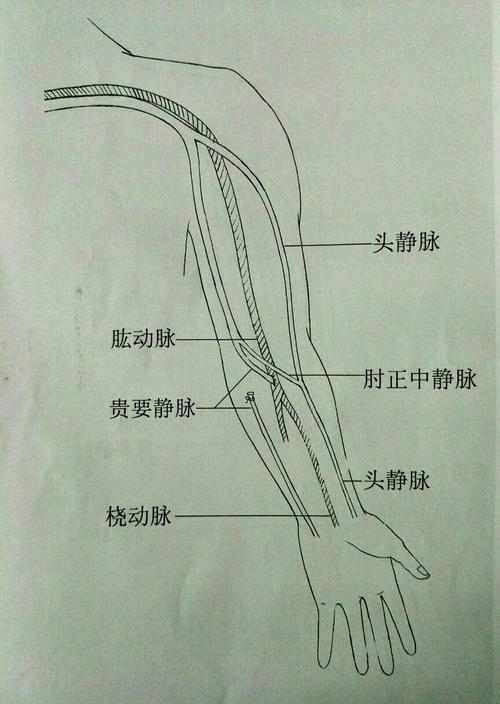 玻璃划破手臂，后果能有多严重？这名22岁患者辗转两家医院未果