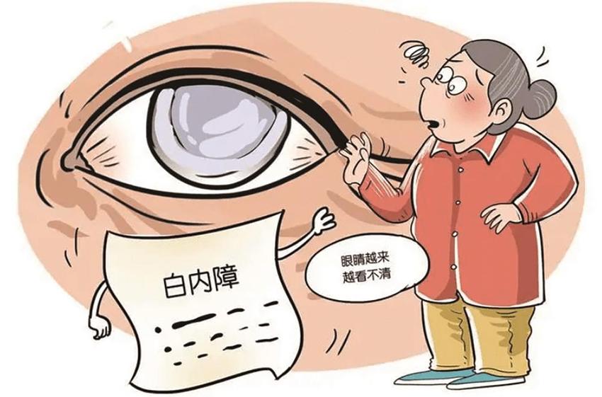 老年性白内障：认识它、面对它、战胜它