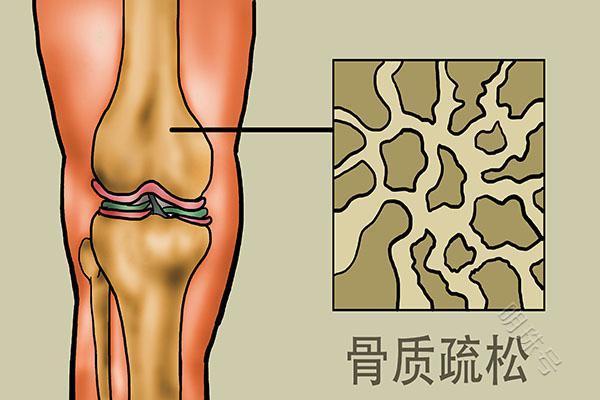 超重依旧不减肥，将会面临什么？建议多了解下