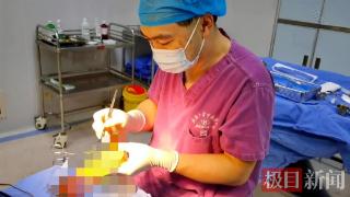 杭州女子甲沟炎反复发作，自驾约800公里来武汉求医