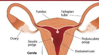 女性早起第一泡尿，若没有这些表现，或许表明你的子宫还不错