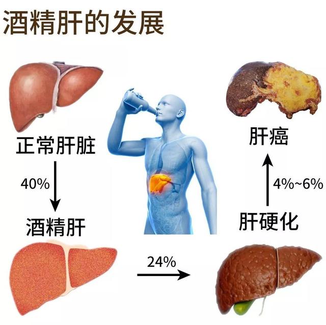 酒精肝会给大家带来哪些危害？医生提醒：如有酒精肝要及时治疗